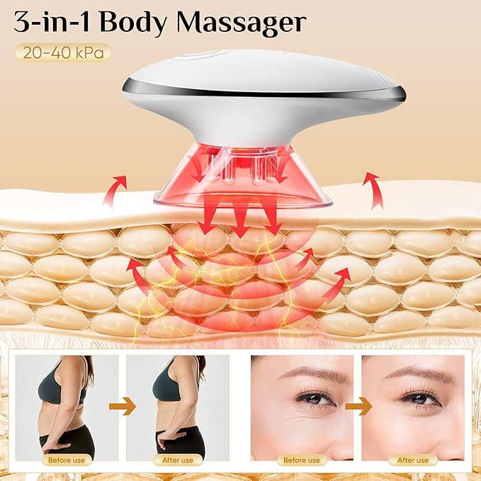 Body Smart Scraping - 3 in 1 Body Sculpting Machine - Best Cellulite Removal Machine- Body Sculptor，Suitable for Legs, Abdomen, Arms, Love Handles, Relieves Muscle Tension and Tightens Skin